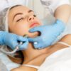 Microdermabrasion (Face)
