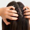 Dandruff Treatment (1 Hour)