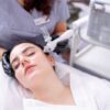 Oxy Facial