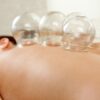 Body Cupping With Massage